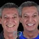Slider image (7) Proesthetic Dental Care in Los Algodones, Mexico